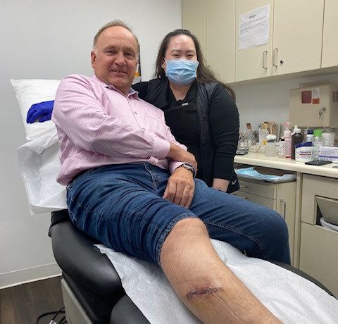 Hombre con incisión quirúrgica de melanoma en la pierna