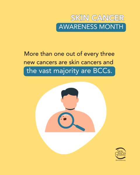 Skin Cancer Awareness Month image with a person examining a mole with a magnifying glass, alongside the statistic that more than one out of every three new cancers are skin cancers.