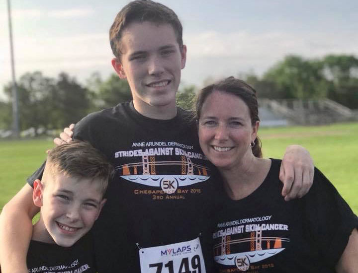 Avances contra el cáncer de piel