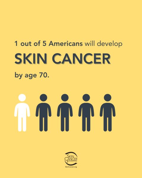 A visual representation of the statistic that 1 in 5 Americans will develop skin cancer by age 70, featuring 5 figures, with one in white and the rest in dark blue, and the Skin Cancer Foundation logo.